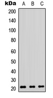 RHOA Antibody - Western blot analysis of RhoA expression in HepG2 (A); MCF7 (B); HL60 (C) whole cell lysates.