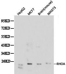 RHOA Antibody - Western blot of RhoA pAb in extracts from HepG2, MCF7 cells, mouse brain tissue and NIH3T3 cells.