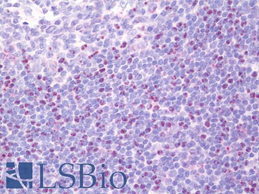 RHOA Antibody - Human Tonsil: Formalin-Fixed, Paraffin-Embedded (FFPE).  This image was taken for the unconjugated form of this product. Other forms have not been tested.
