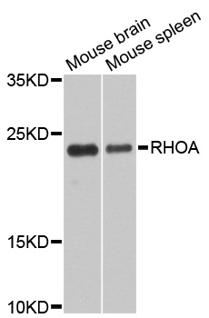 RHOA Antibody - Western blot analysis of extracts of various cell lines, using RhoA antibody at 1:1000 dilution. The secondary antibody used was an HRP Goat Anti-Rabbit IgG (H+L) at 1:10000 dilution. Lysates were loaded 25ug per lane and 3% nonfat dry milk in TBST was used for blocking. An ECL Kit was used for detection and the exposure time was 10s.
