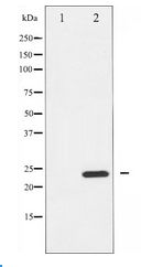 RHOA Antibody - Western blot of RhoA expression in HeLa whole cell lysates,The lane on the left is treated with the antigen-specific peptide.