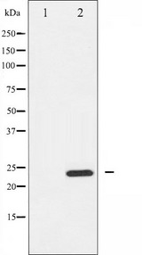 RHOA Antibody - Western blot analysis of RhoA expression in HeLa whole cells lysates. The lane on the left is treated with the antigen-specific peptide.