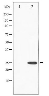 RHOA Antibody - Western blot of RhoA phosphorylation expression in HeLa whole cell lysates,The lane on the left is treated with the antigen-specific peptide.