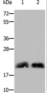 RHOB Antibody - Western blot analysis of Mouse brain and fetal brain tissue, using RHOB Polyclonal Antibody at dilution of 1:800.