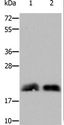 RHOB Antibody - Western blot analysis of Mouse brain and fetal brain tissue, using RHOB Polyclonal Antibody at dilution of 1:800.