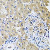 RHOB Antibody - Immunohistochemistry of paraffin-embedded human liver injury tissue.