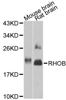 RHOB Antibody - Western blot analysis of extracts of various cell lines, using RHOB antibody at 1:1000 dilution. The secondary antibody used was an HRP Goat Anti-Rabbit IgG (H+L) at 1:10000 dilution. Lysates were loaded 25ug per lane and 3% nonfat dry milk in TBST was used for blocking. An ECL Kit was used for detection and the exposure time was 90s.