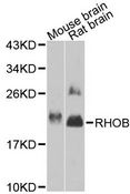 RHOB Antibody - Western blot analysis of extracts of various cell lines, using RHOB antibody at 1:1000 dilution. The secondary antibody used was an HRP Goat Anti-Rabbit IgG (H+L) at 1:10000 dilution. Lysates were loaded 25ug per lane and 3% nonfat dry milk in TBST was used for blocking. An ECL Kit was used for detection and the exposure time was 90s.