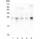 RHOB Antibody - Western blot testing of human 1) placenta, 2) HepG2, 3) T-47D, 4) HeLa and 5) monkey COS-7 lysate with RHOB antibody at 0.5ug/ml. Predicted molecular weight ~22 kDa.
