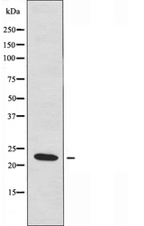 RHOB Antibody - Western blot analysis of extracts of HepG2 cells using RHOB antibody.
