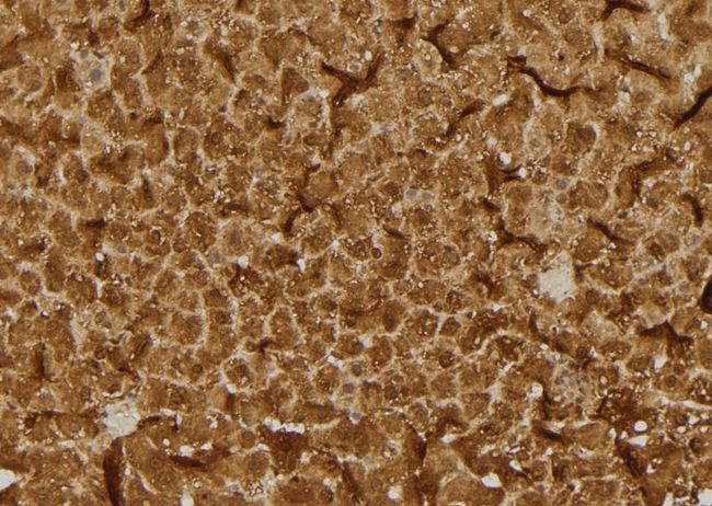 RHOB Antibody - 1:100 staining rat liver tissue by IHC-P. The sample was formaldehyde fixed and a heat mediated antigen retrieval step in citrate buffer was performed. The sample was then blocked and incubated with the antibody for 1.5 hours at 22°C. An HRP conjugated goat anti-rabbit antibody was used as the secondary.