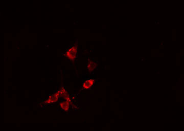 RHOB Antibody - Staining HepG2 cells by IF/ICC. The samples were fixed with PFA and permeabilized in 0.1% Triton X-100, then blocked in 10% serum for 45 min at 25°C. The primary antibody was diluted at 1:200 and incubated with the sample for 1 hour at 37°C. An Alexa Fluor 594 conjugated goat anti-rabbit IgG (H+L) antibody, diluted at 1/600, was used as secondary antibody.