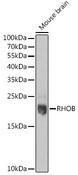 RHOB Antibody - Western blot analysis of extracts of Mouse brain using RHOB Polyclonal Antibody at dilution of 1:1000.