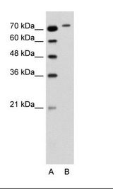 RHOBTB1 Antibody - A: Marker, B: Jurkat Cell Lysate.  This image was taken for the unconjugated form of this product. Other forms have not been tested.