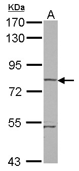 RHOBTB1 Antibody - Sample (30 ug of whole cell lysate) A: A431 7.5% SDS PAGE RHOBTB1 antibody diluted at 1:5000