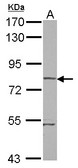 RHOBTB1 Antibody - Sample (30 ug of whole cell lysate) A: A431 7.5% SDS PAGE RHOBTB1 antibody diluted at 1:5000