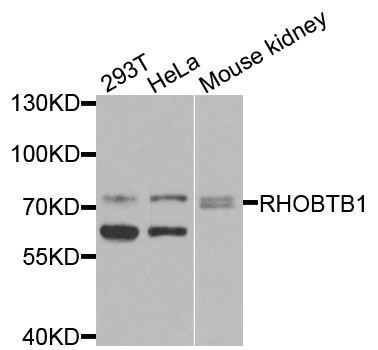 RHOBTB1 Antibody - Western blot analysis of extracts of various cells.