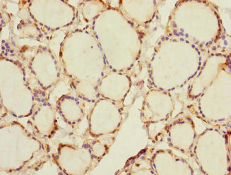 RHOBTB1 Antibody - Immunohistochemistry of paraffin-embedded human thyroid tissue at dilution 1:100