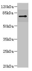 RHOBTB1 Antibody - Western blot All Lanes: RHOBTB1 antibody IgG at 3.17ug/ml+ 293T whole cell lysate Secondary Goat polyclonal to rabbit IgG at 1/10000 dilution Predicted band size: 79 kDa Observed band size: 79 kDa