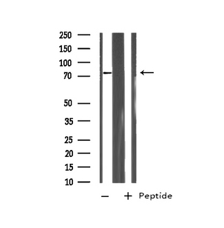 RHOBTB2 / DBC2 Antibody - Western blot analysis on HepG2 cell lysates using RHBT2 antibody