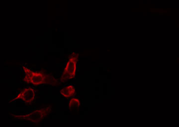 RHOBTB2 / DBC2 Antibody - Staining HepG2 cells by IF/ICC. The samples were fixed with PFA and permeabilized in 0.1% Triton X-100, then blocked in 10% serum for 45 min at 25°C. The primary antibody was diluted at 1:200 and incubated with the sample for 1 hour at 37°C. An Alexa Fluor 594 conjugated goat anti-rabbit IgG (H+L) antibody, diluted at 1/600, was used as secondary antibody.