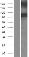RHOBTB2 / DBC2 Protein - Western validation with an anti-DDK antibody * L: Control HEK293 lysate R: Over-expression lysate