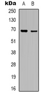 RHOBTB3 Antibody - Western blot analysis of RhoBTB3 expression in A10 (A); K562 (B) whole cell lysates.