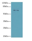 RHOBTB3 Antibody - Western blot. All lanes: RHOBTB3 antibody at 12 ug/ml+HeI- whole cell lysate Goat polyclonal to rabbit at 1:10000 dilution. Predicted band size: 69 kDa. Observed band size: 69 kDa.
