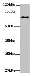 RHOBTB3 Antibody - Western blot All lanes: RHOBTB3 antibody at 12µg/ml + Hela whole cell lysate Secondary Goat polyclonal to rabbit IgG at 1/10000 dilution Predicted band size: 69 kDa Observed band size: 69 kDa