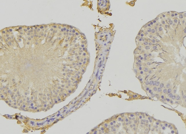 RHOBTB3 Antibody - 1:100 staining rat testis tissue by IHC-P. The sample was formaldehyde fixed and a heat mediated antigen retrieval step in citrate buffer was performed. The sample was then blocked and incubated with the antibody for 1.5 hours at 22°C. An HRP conjugated goat anti-rabbit antibody was used as the secondary.