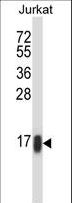 RHOC Antibody - RHOC Antibody western blot of Jurkat cell line lysates (35 ug/lane). The RHOC antibody detected the RHOC protein (arrow).
