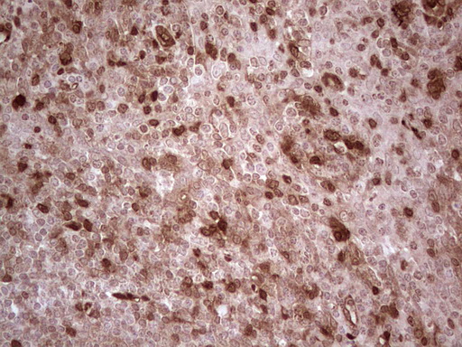 RHOC Antibody - Immunohistochemical staining of paraffin-embedded Human tonsil within the normal limits using anti-RHOC mouse monoclonal antibody. (Heat-induced epitope retrieval by 1 mM EDTA in 10mM Tris, pH8.5, 120C for 3min,
