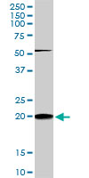 RHOC Antibody - RHOC monoclonal antibody (M01), clone 2E12. Western Blot analysis of RHOC expression in PC-12.