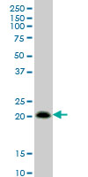RHOC Antibody - RHOC monoclonal antibody (M01), clone 2E12 Western Blot analysis of RHOC expression in Jurkat.