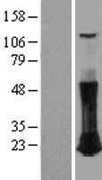 RHOC Protein - Western validation with an anti-DDK antibody * L: Control HEK293 lysate R: Over-expression lysate