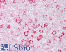 RHOD Antibody - Anti-RHOD antibody IHC of human tonsil. Immunohistochemistry of formalin-fixed, paraffin-embedded tissue after heat-induced antigen retrieval. Antibody concentration 5 ug/ml.  This image was taken for the unconjugated form of this product. Other forms have not been tested.