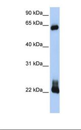 RHOD Antibody - Transfected 293T cell lysate. Antibody concentration: 1.0 ug/ml. Gel concentration: 12%.  This image was taken for the unconjugated form of this product. Other forms have not been tested.