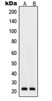 RHOD Antibody - Western blot analysis of RhoD expression in K562 (A); Raw264.7 (B) whole cell lysates.