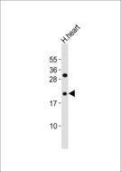 RHOD Antibody - Anti-RhoD Antibody at 1:1000 dilution + H.heart tissue lysates Lysates/proteins at 20 ug per lane. Secondary Goat Anti-Rabbit IgG, (H+L),Peroxidase conjugated at 1/10000 dilution Predicted band size : 23 kDa Blocking/Dilution buffer: 5% NFDM/TBST.
