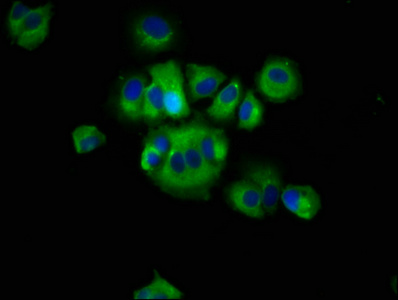 RHOD Antibody - Immunofluorescence staining of MCF-7 cells at a dilution of 1:66, counter-stained with DAPI. The cells were fixed in 4% formaldehyde, permeabilized using 0.2% Triton X-100 and blocked in 10% normal Goat Serum. The cells were then incubated with the antibody overnight at 4 °C.The secondary antibody was Alexa Fluor 488-congugated AffiniPure Goat Anti-Rabbit IgG (H+L) .