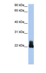 RHOD Antibody - Transfected 293T cell lysate. Antibody concentration: 1.0 ug/ml. Gel concentration: 12%.  This image was taken for the unconjugated form of this product. Other forms have not been tested.