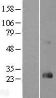 RHOD Protein - Western validation with an anti-DDK antibody * L: Control HEK293 lysate R: Over-expression lysate