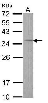 Rhodanese / TST Antibody - Sample (30 ug of whole cell lysate). A: Hep G2 . 12% SDS PAGE. Rhodanese / TST antibody diluted at 1:1000.