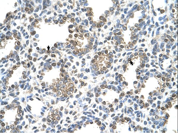 Rhodanese / TST Antibody - Human Lung.  This image was taken for the unconjugated form of this product. Other forms have not been tested.