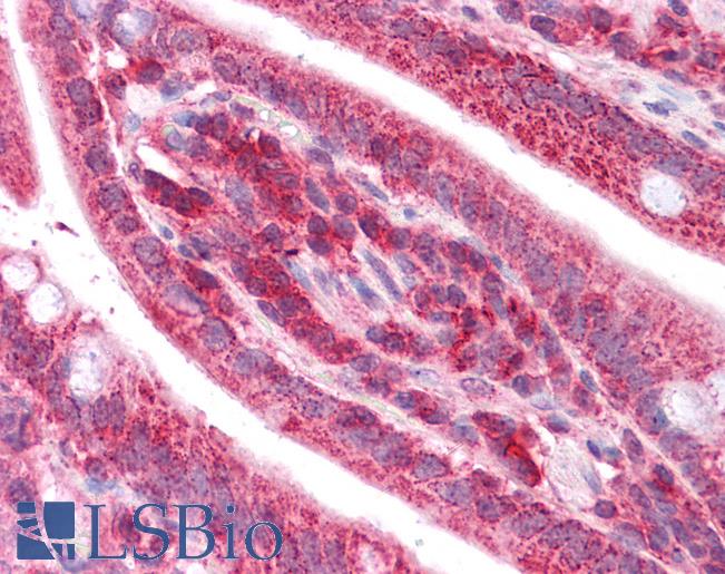 Rhodanese / TST Antibody - Anti-TST antibody IHC of human small intestine. Immunohistochemistry of formalin-fixed, paraffin-embedded tissue after heat-induced antigen retrieval. Antibody concentration 5 ug/ml.  This image was taken for the unconjugated form of this product. Other forms have not been tested.