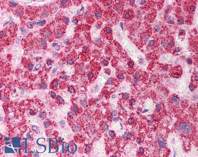 Rhodanese / TST Antibody - Anti-TST antibody IHC of human liver. Immunohistochemistry of formalin-fixed, paraffin-embedded tissue after heat-induced antigen retrieval. Antibody concentration 5 ug/ml.  This image was taken for the unconjugated form of this product. Other forms have not been tested.