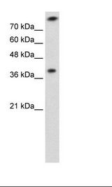 Rhodanese / TST Antibody - Jurkat Cell Lysate.  This image was taken for the unconjugated form of this product. Other forms have not been tested.