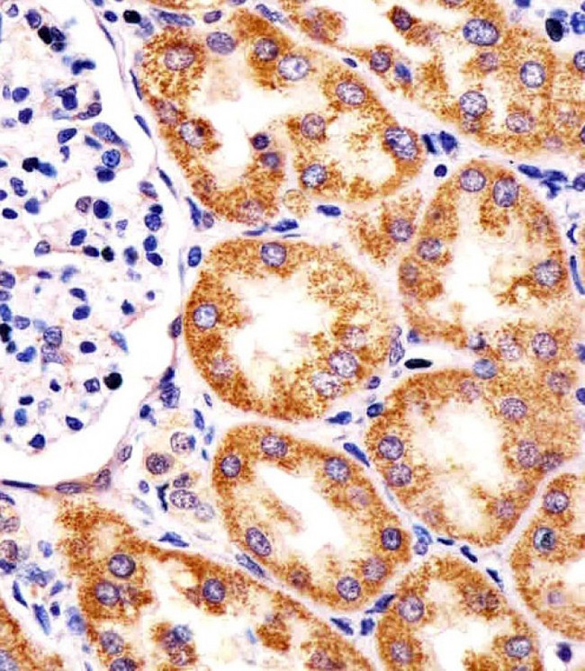 Rhodanese / TST Antibody - Antibody staining TST in human kidney tissue sections by Immunohistochemistry (IHC-P - paraformaldehyde-fixed, paraffin-embedded sections). Tissue was fixed with formaldehyde and blocked with 3% BSA for 0. 5 hour at room temperature; antigen retrieval was by heat mediation with a citrate buffer (pH 6). Samples were incubated with primary antibody (1:25) for 1 hours at 37°C. A undiluted biotinylated goat polyvalent antibody was used as the secondary antibody.
