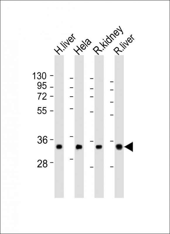 Rhodanese / TST Antibody - All lanes: Anti-TST Antibody (Center) at 1:2000 dilution. Lane 1: human liver lysate. Lane 2: HeLa whole cell lysate. Lane 3: rat kidney lysate. Lane 4: rat liver lysate Lysates/proteins at 20 ug per lane. Secondary Goat Anti-Rabbit IgG, (H+L), Peroxidase conjugated at 1:10000 dilution. Predicted band size: 33 kDa. Blocking/Dilution buffer: 5% NFDM/TBST.