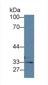 Rhodanese / TST Antibody - Western Blot; Sample: Human HepG2 cell lysate; Primary Ab: 1µg/ml Rabbit Anti-Mouse TST Antibody Second Ab: 0.2µg/mL HRP-Linked Caprine Anti-Rabbit IgG Polyclonal Antibody
